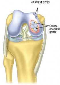 fibrocartilage